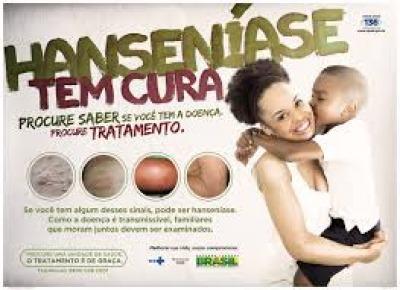  Imagem - Hanseníase Tem Cura 